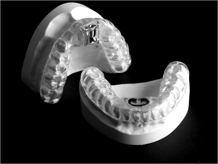 TAP, MAD, apparecchio antirussamento, apnea notturna, Thornton